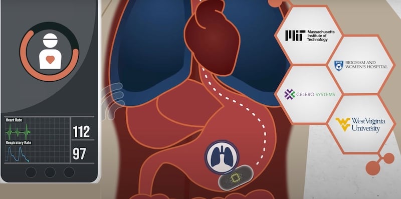 Ingestible Sensor Completes First In-Human Trial to Monitor Vital Signs ...