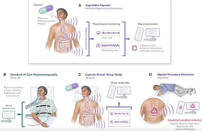 Ingestible Sensor Completes First In-Human Trial to Monitor Vital Signs ...
