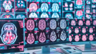 Smarter Medical Imaging with COMs