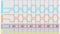 Back to Basics: SPI (Serial Peripheral Interface)