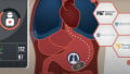 Ingestible Sensor Completes First In-Human Trial to Monitor Vital Signs