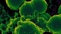 Devices with Programmable Genes? The US Army Wants to Put Bacteria into Electronics