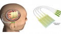 The Head and the Heart: UC San Diego Engineers Devise Neural and Cardiac Sensors