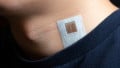 Ultrasound Patches Provide Continuous Imaging of Internal Organs