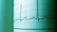 Goodbye Cuff: AI Radar Monitors Heart Health Across the Room