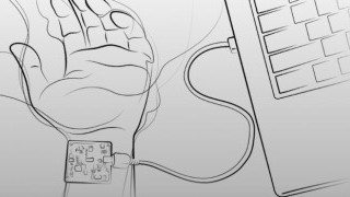 Continuous-Wave Radar Systems May Replace Cuffed Blood Pressure Armbands