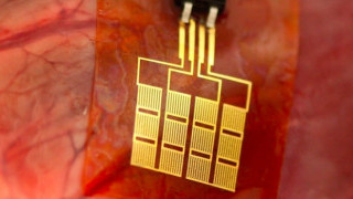 Powering a Pacemaker from Within: a Light-Harvesting Implant May Eliminate Battery-Replacement Surgery