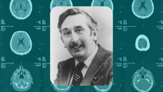 Historical Engineers: Godfrey Hounsfield, the Brains Behind the CT Scan