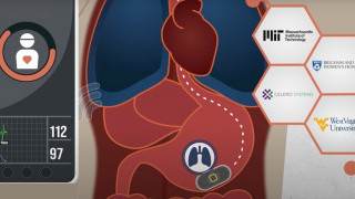 Ingestible Sensor Completes First In-Human Trial to Monitor Vital Signs