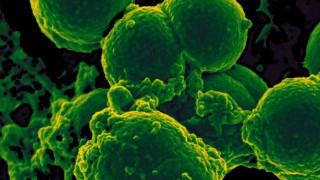 Devices with Programmable Genes? The US Army Wants to Put Bacteria into Electronics