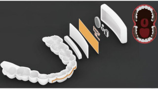 MIT Researchers Craft Mouthpiece With Sensors and Hands-Free Interface