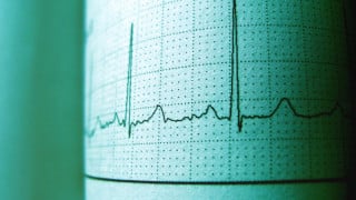 Goodbye Cuff: AI Radar Monitors Heart Health Across the Room