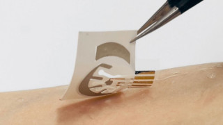 Wearable Tracks Meds for Patients With Bipolar Disorder Through Sweat