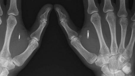 Wearables Roundup: Bio-hacking, Ford Motors, and Sensors that Stick to Your Body