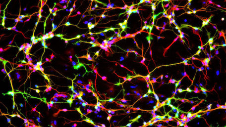 Electronic Synapses: One Step Closer to Creating Artificial Neural Networks
