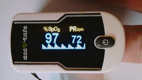 Teardown Tuesday: Pulse Oximeter