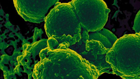 Devices with Programmable Genes? The US Army Wants to Put Bacteria into Electronics