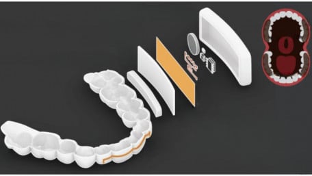MIT Researchers Craft Mouthpiece With Sensors and Hands-Free Interface