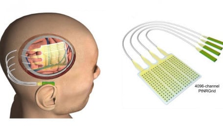 The Head and the Heart: UC San Diego Engineers Devise Neural and Cardiac Sensors