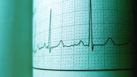 Goodbye Cuff: AI Radar Monitors Heart Health Across the Room