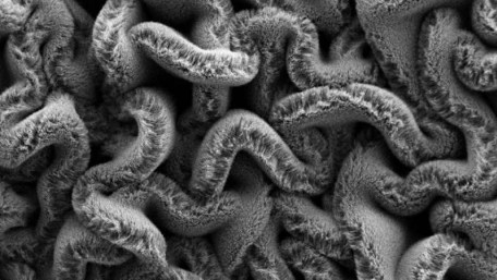 Stretchable Supercapacitors for the Next Stage of Wearables