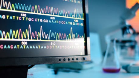 The Hardware Side of Bioinformatics: Protein Sequenator to Raspberry Pi