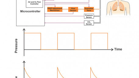 An Engineer’s Introduction to Mechanical Ventilation