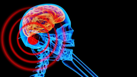 Electromagnetic Radiation Is Decreasing in New Generations of Smartphones
