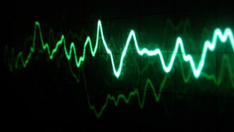 Phase Response in Active Filters: The Band-Pass Response