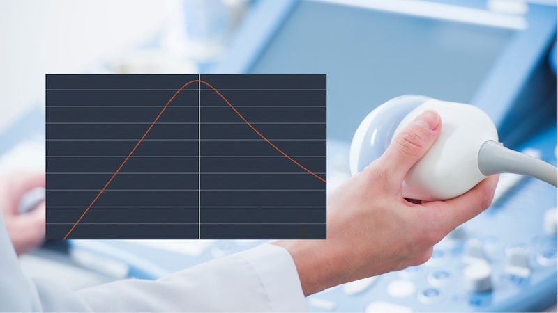 Designing a Tuneable Ultrasonic Filter