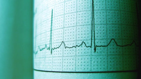 Goodbye Cuff: AI Radar Monitors Heart Health Across the Room